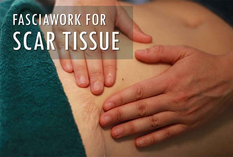 Fasciawork for scar tissue